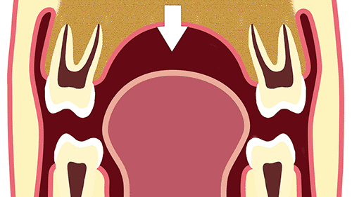 3.gif